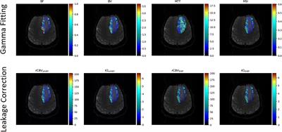 Investigating the value of radiomics stemming from DSC quantitative biomarkers in IDH mutation prediction in gliomas